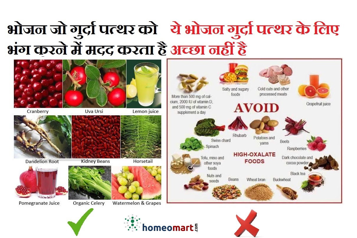 Diet Chart For Kidney Stone Patient In Hindi