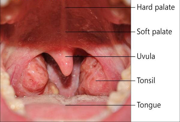 Throat cancer symptoms explanation images