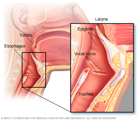 Throat cancer symptoms explanation images