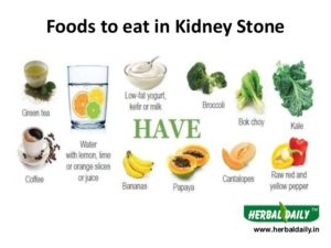 Kidney stone diet chart – Printable graphics